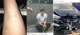 Alden Richards is safe from a Minor Car Accident