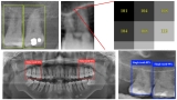 Filipino Scientists Develop AI to Improve Dental X-ray Analysis