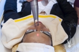 Laser scar removal facts: 6 things I learned in my journey to flawless