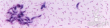 Understanding Toxoplasmosis: Safely Preparing Fresh Produce and Seafood