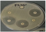 UP researchers are now using AI to predict bacterial threats