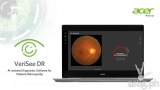 Acer is set to expand diabetic retinopathy screening by launching AI-assisted diagnostic solution to local hospitals and clinics