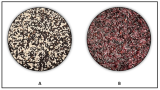 Tapuy Rice: The Next Anti-Aging Superfood?